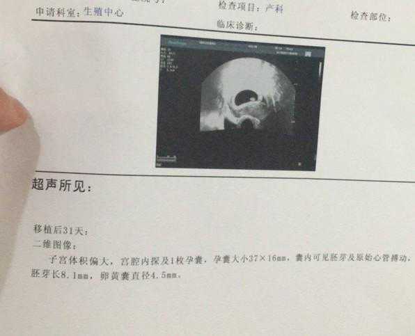 邮寄香港验血需要几天,做试管婴儿解冻6年前冻坯胎，“双胞胎”相差6岁
