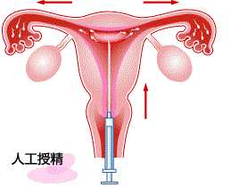 香港验血一般要孕多少天可以验,三孩概念股大涨！专注试管婴儿、人工授精的
